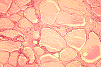 Hormone régulatrice du fer