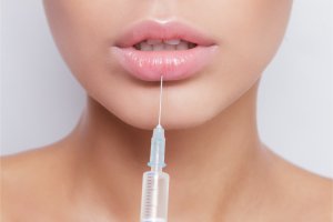 Russian Lips : l essentiel à savoir à propos de cette technique esthét